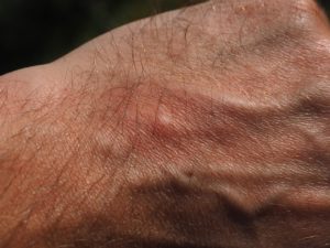 Magnesiumöl sensitiv – die optimale Wahl bei empfindlicher Haut.